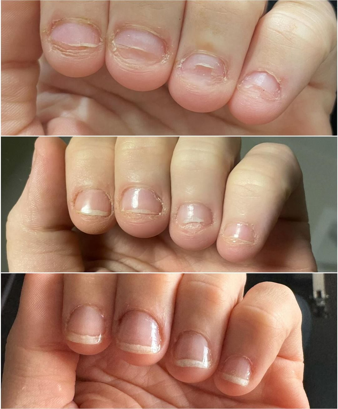 Lele Pons comparte la evolución de sus uñas