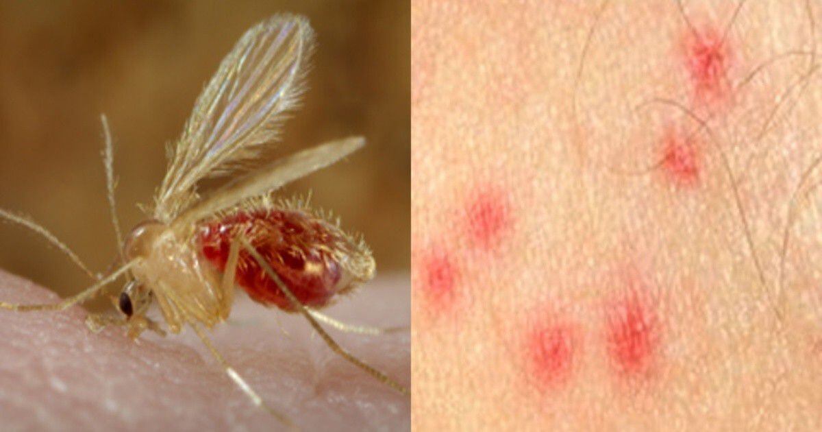 Picadura de mosquito jején