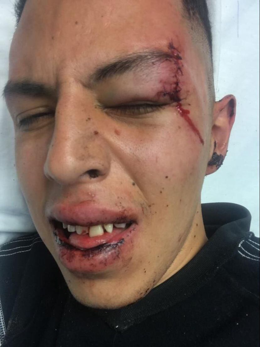 Así quedo el rostro del fan del Club Tigres golpeado brutalmente por seguidores del Club León.